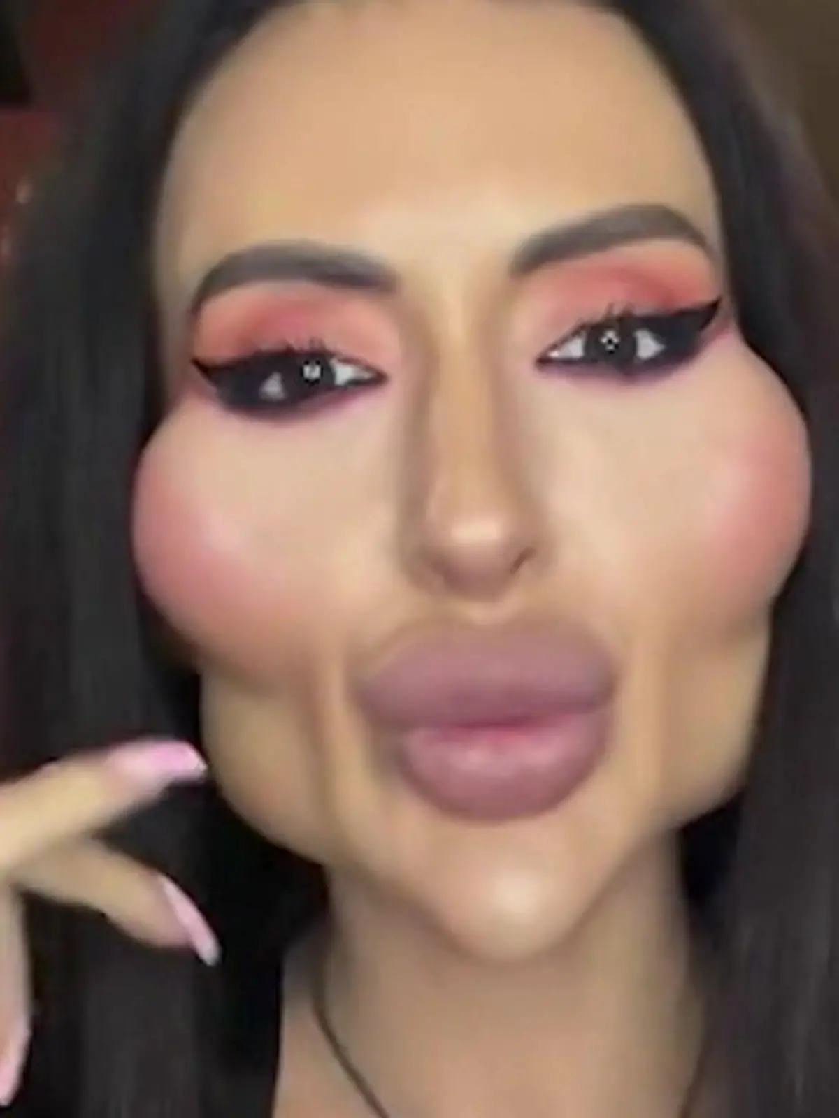 Bild zu: "Anastasia will die größten Wangen der Welt – jetzt fühlt sie sich endlich schön!"