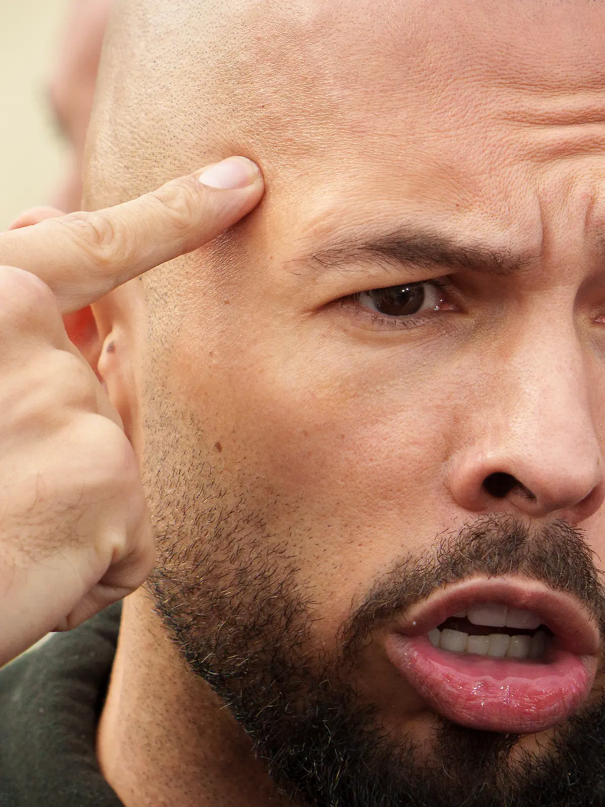 Andrew Tate reacts while speaking to media after checking in at a police station as part of his judicial control, which requires him to appear before judicial authorities in Romania when summoned, in Voluntari, Romania, Monday, March 24, 2025. (AP Photo/Vadim Ghirda)