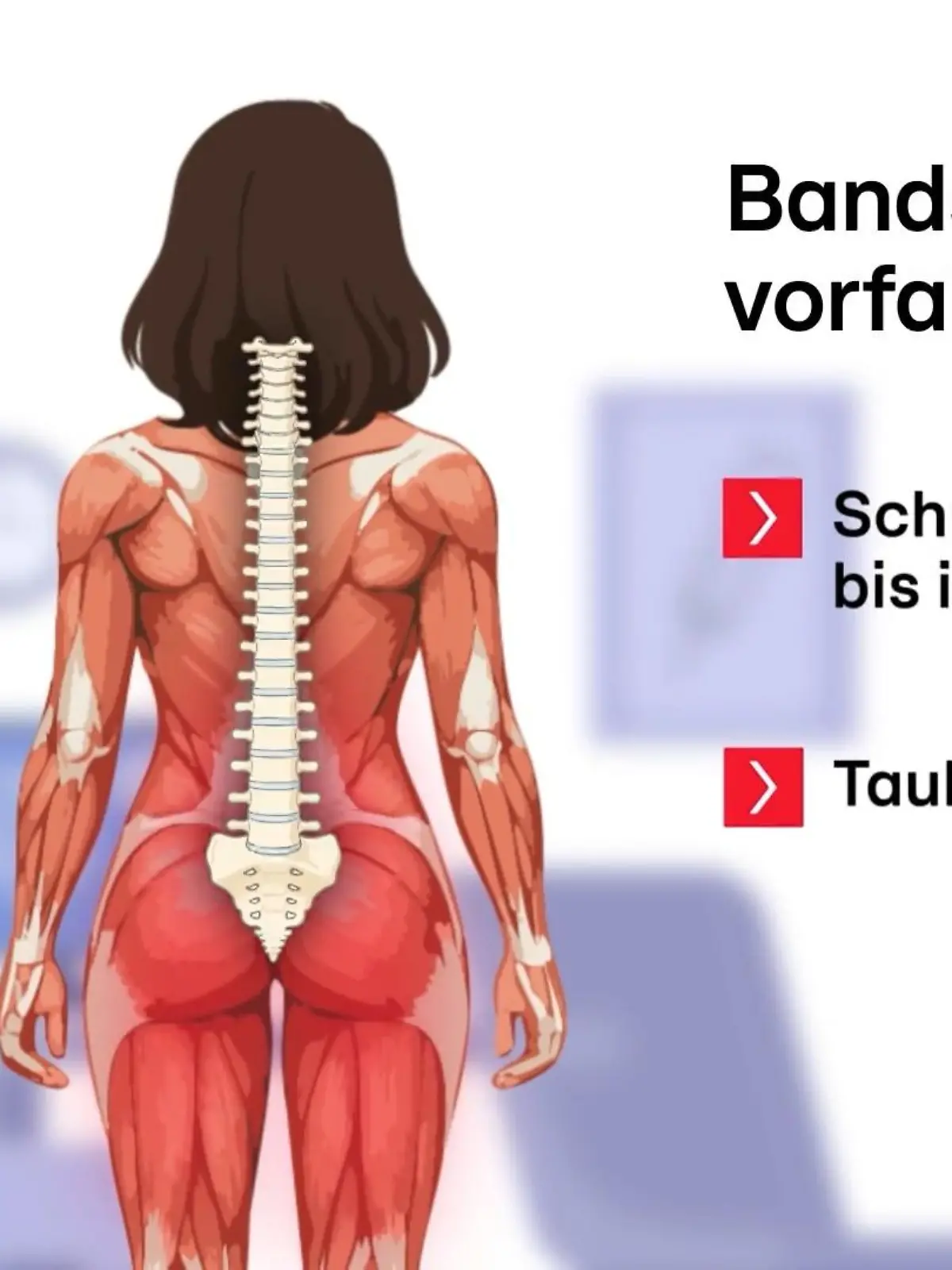 Bild zu: "Wie ihr einen Hexenschuss von einem Bandscheibenvorfall unterscheidet"