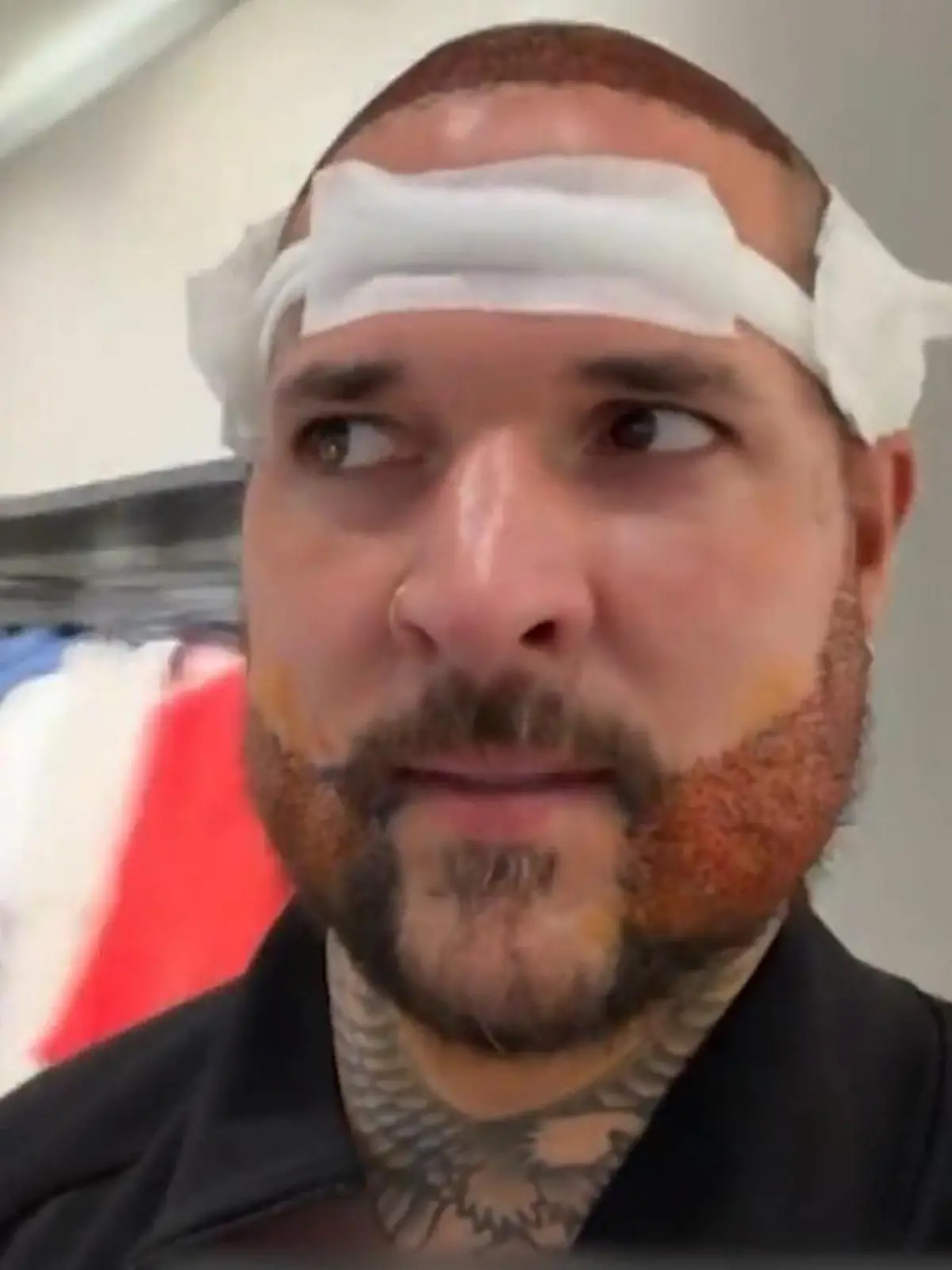 Bild zu: "„Ich fühle mich wie ein Monster!" Reality-Star macht nach Beauty-OP Kindern Angst"