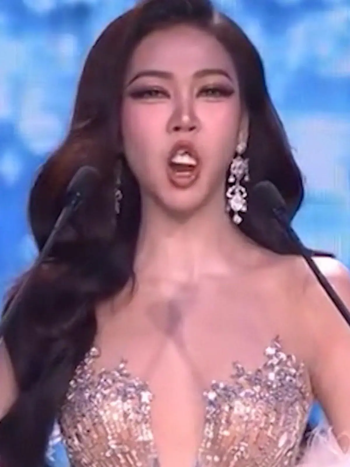 Bild zu: "Peinlich-Panne bei Miss-Wahl! Schönheitskönigin verliert ihre Zähne – bei Live-Auftritt"