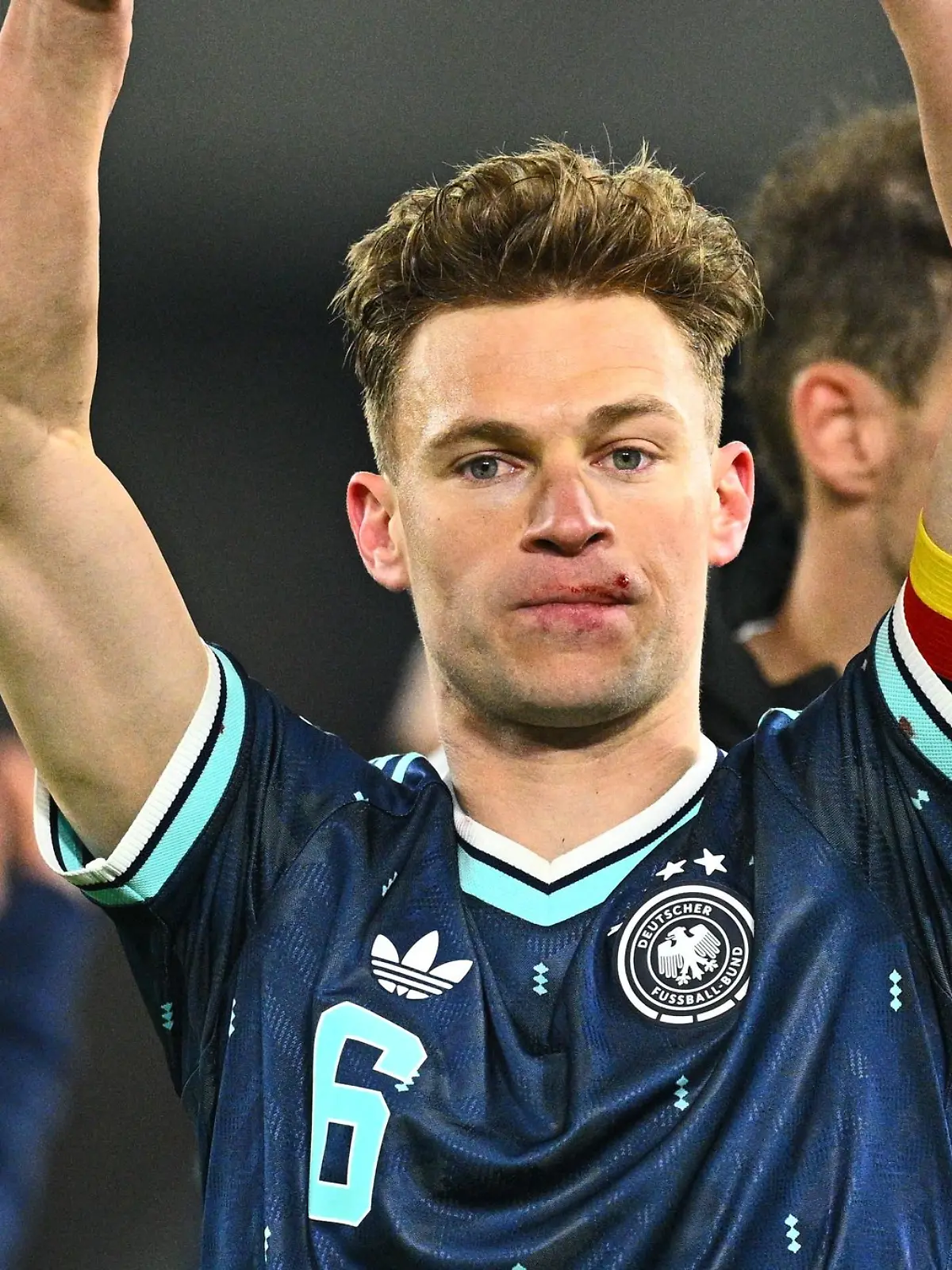 Joshua Kimmich feiert mit einer Verletzung an der Lippe den Sieg in der Schweiz.