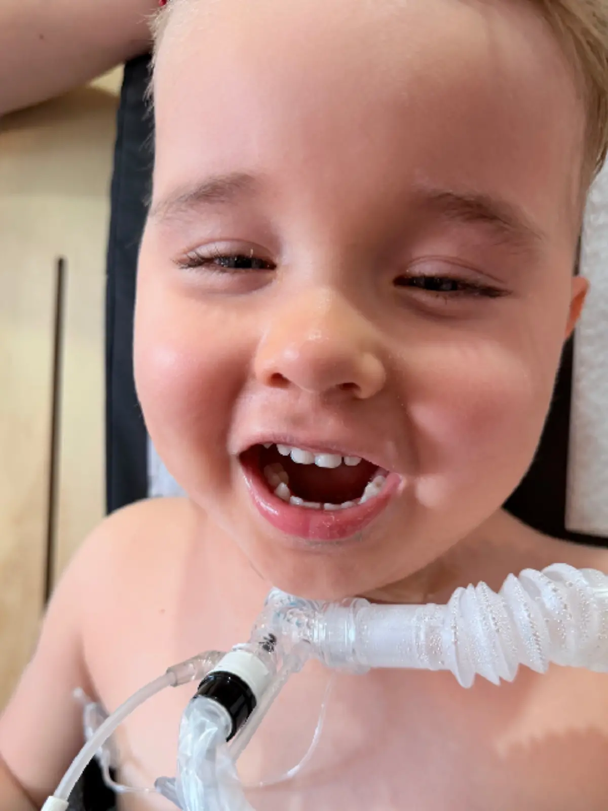 Der kleine Olli kann schon wieder länger selbstständig atmen.