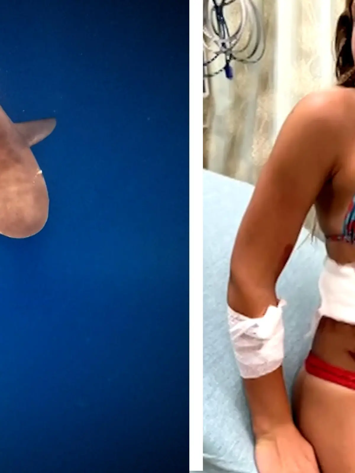 Die 13-jährige Ella Reed wurde am Pierce Beach in Florida von einem Bullenhai angegriffen. Direkt danach musste sie ins Krankenhaus und wurde dort mit 19 Stichen genäht. In einem Interview spricht sie jetzt gemeinsam mit ihrer Mutter über den Vorfall.