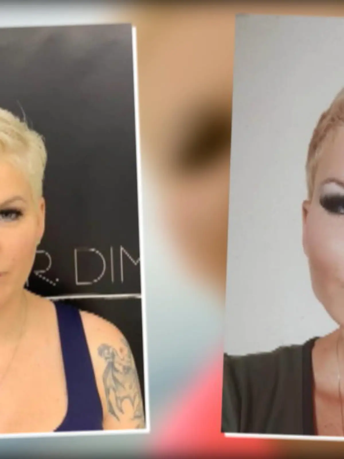 Fans erkennen ihr Gesicht kaum wieder: Melanie Müller hat das Ergebnis ihrer Schönheits-OP bei Instagram geteilt. Beim Schönheitschirurgen hat sie einiges machen lassen: Nasenkorrektur, Lippenaufspritzung, Botox und eine Gesichts-Modellierung.