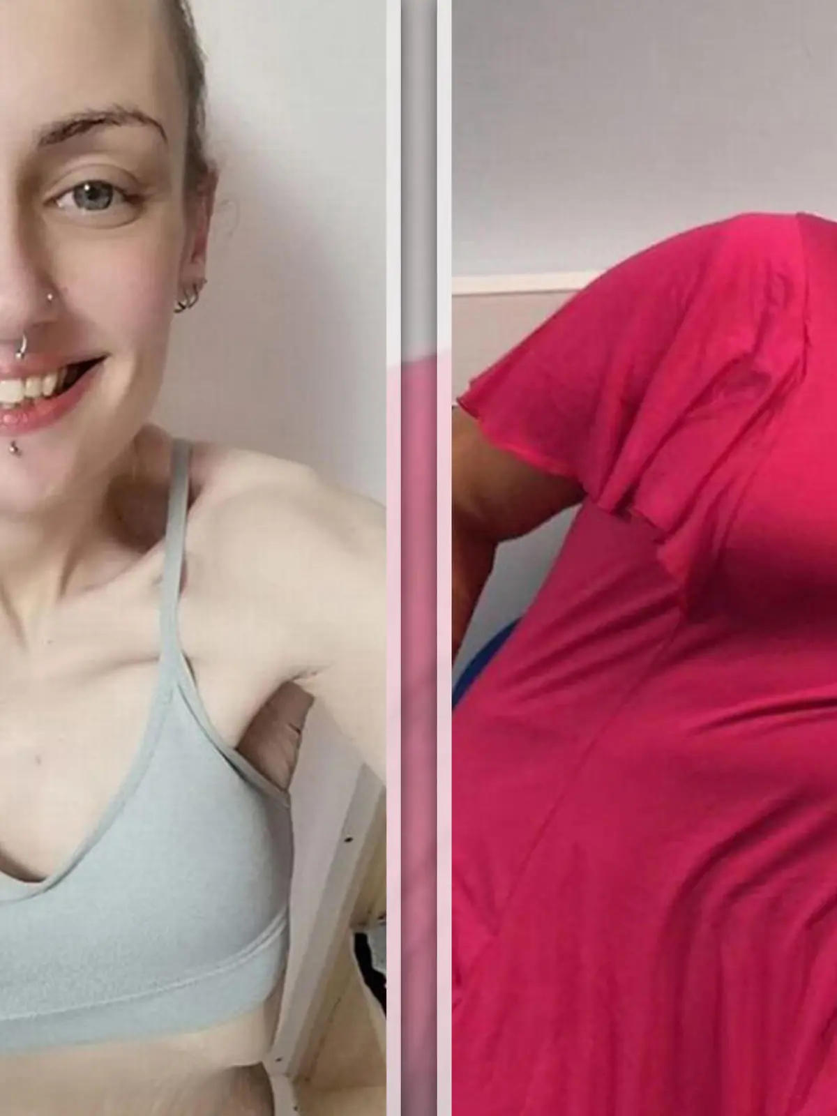 Links ist die magersüchtige Natalie, die vorher jahrelang mit 120 stark übergewichtig war.