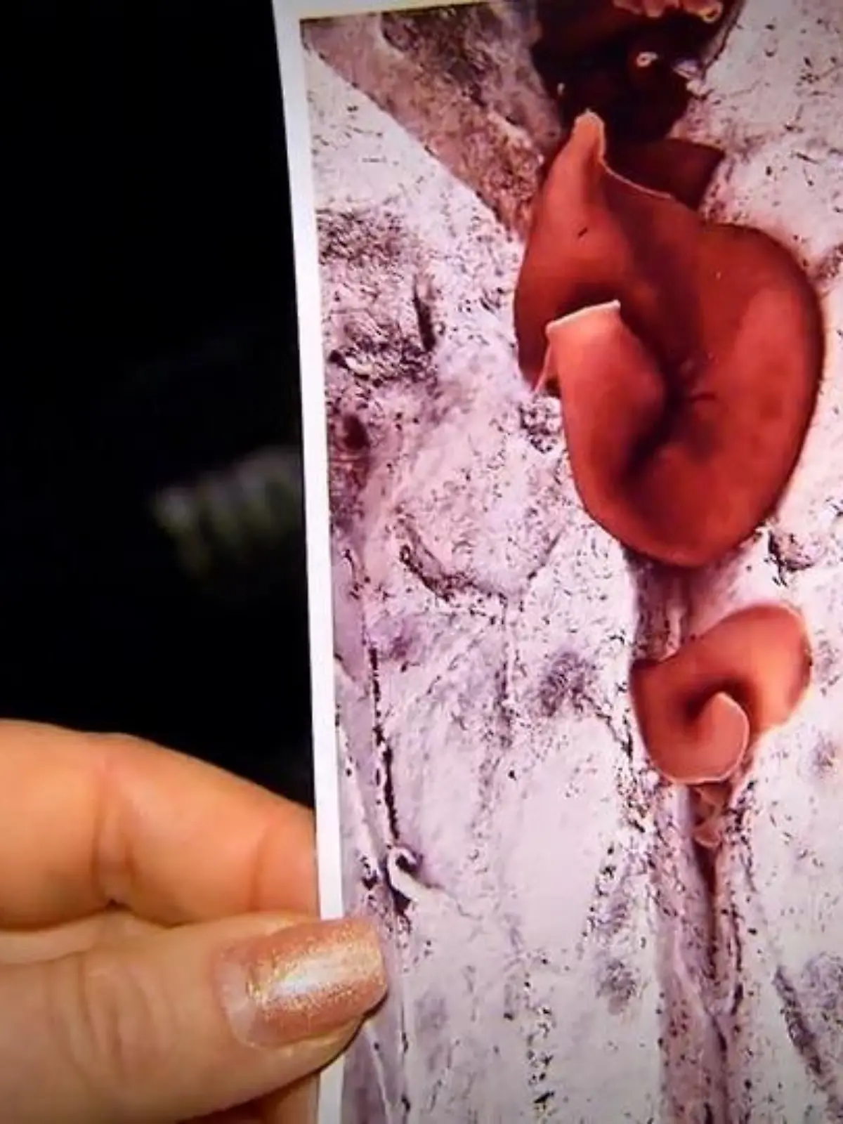 Bild zu: "Schimmel überall! Familie lebt im absoluten Horrorhaus"