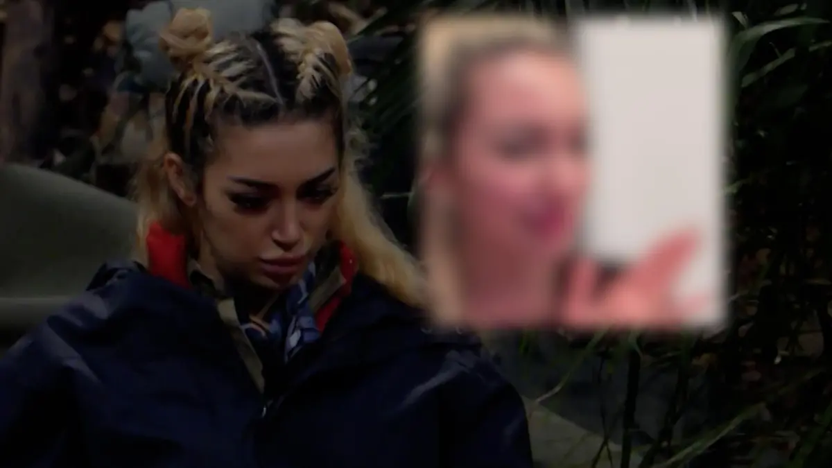 Dschungelcamp-Star erkennt sich nicht wieder – wegen Schönheitseingriff! Ariel trennt sich von dicker Lippe