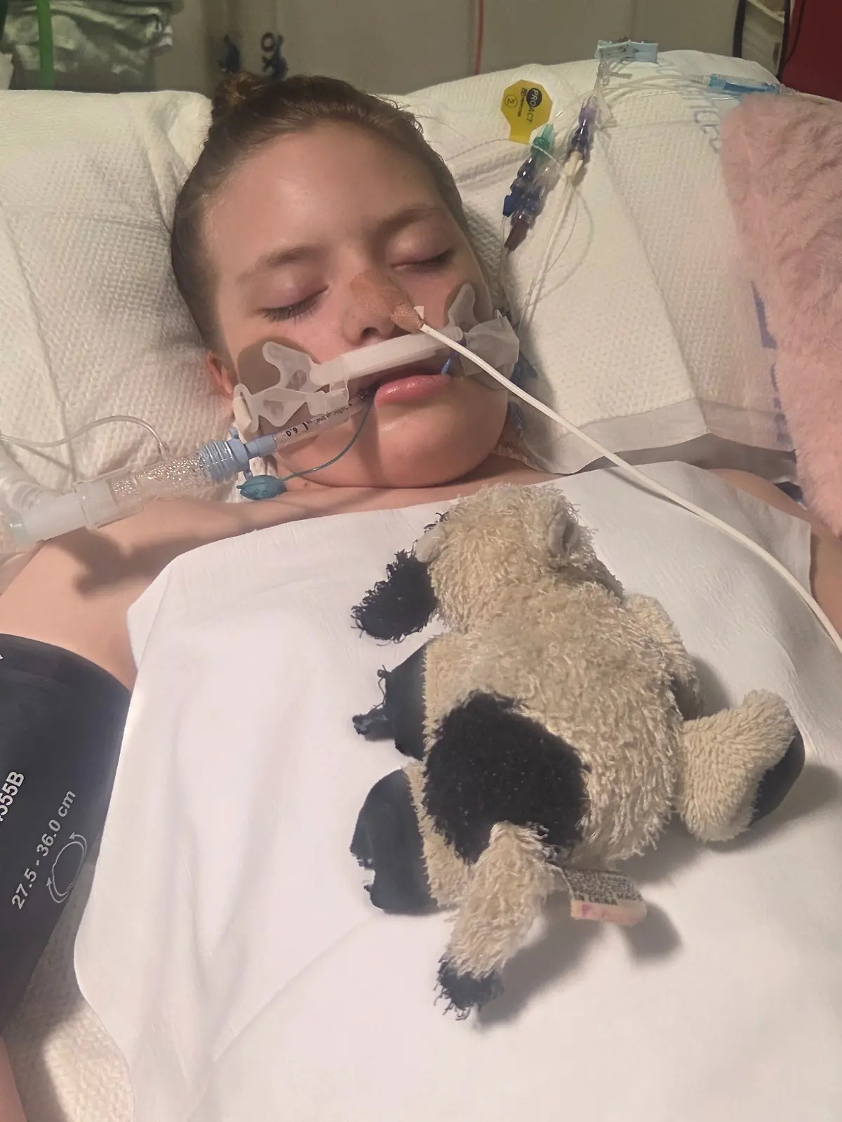 Die Ärzte hielten die Symptome der Dreizehnjährigen zunächst für einen Magen-Darm-Infekt, einen Monat später wurde sie jedoch in ein künstliches Koma versetzt.