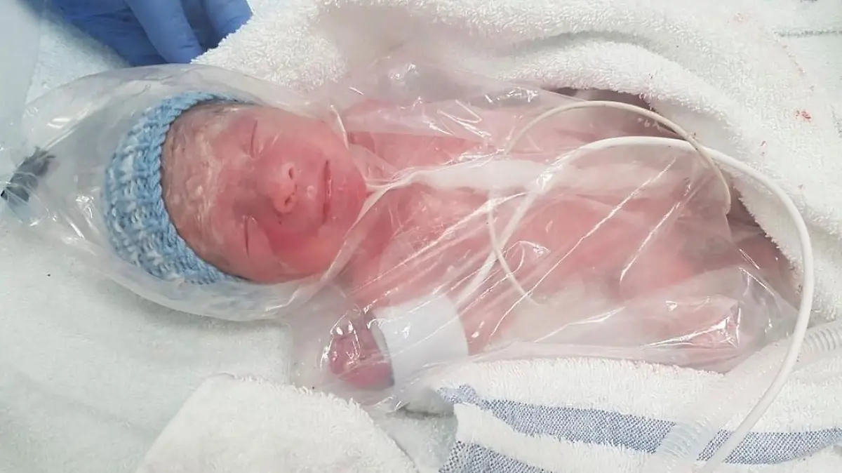 Baby Zaki ist eingewickelt in einer Sandwich-Tüte. Der Kleine kommt drei Monate zu früh zur Welt. Im Mutterbauch hätte er es jetzt noch schön warm gehabt.