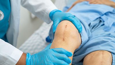 Muss vor jeder OP eine Zweitmeinung her? Das plant die Gesundheitsministerin!