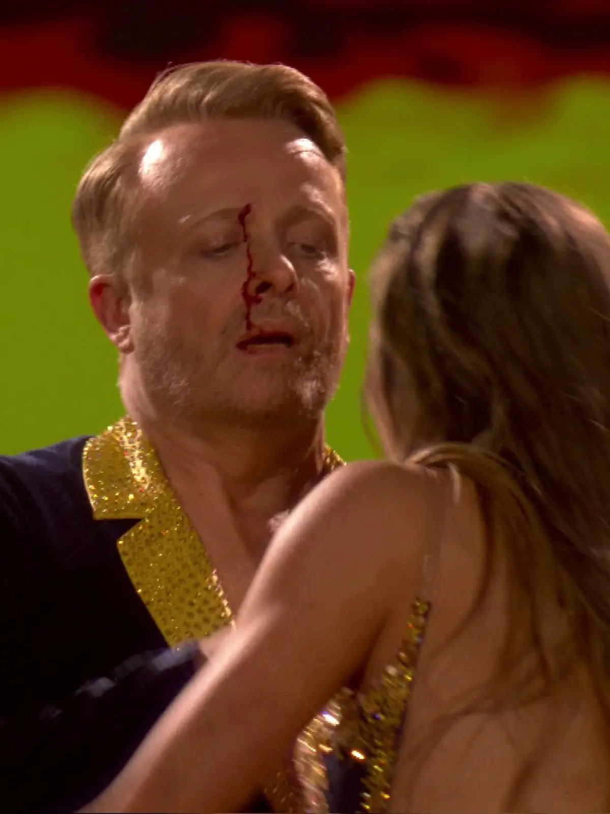 Ross Antony mit Blut im Gesicht