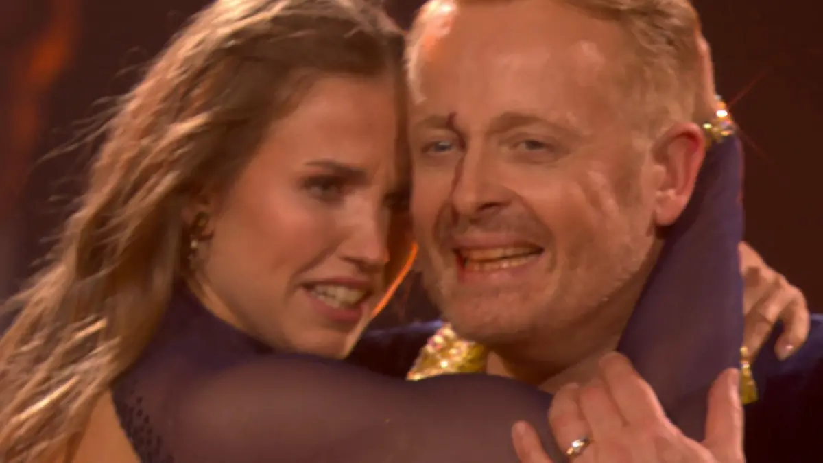 Schlimme Bilder: Während der Sendung lief Ross das Blut von seiner kleinen Platzwunde bis in den Mund. Zum Glück aber alles nur halb so wild. 