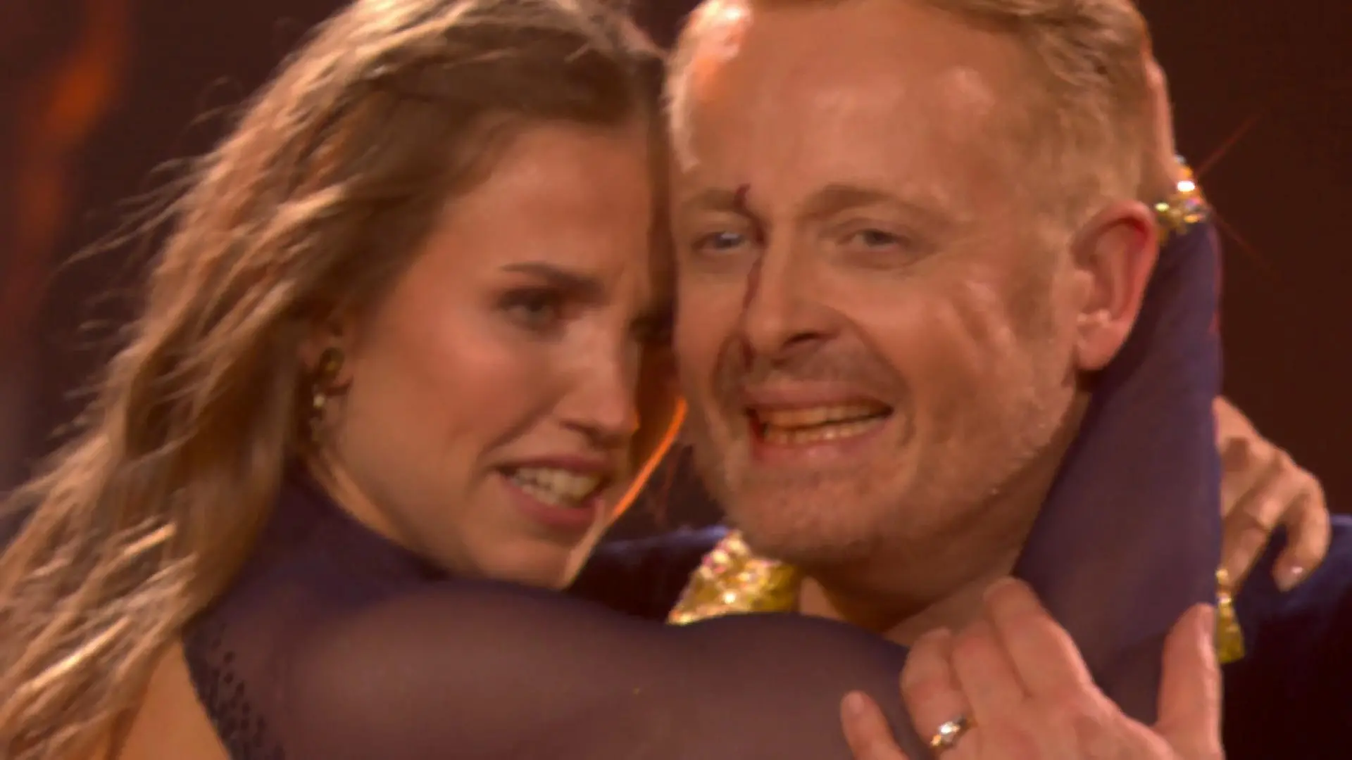 Schlimme Bilder: Während der Sendung lief Ross das Blut von seiner kleinen Platzwunde bis in den Mund. Zum Glück aber alles nur halb so wild. 