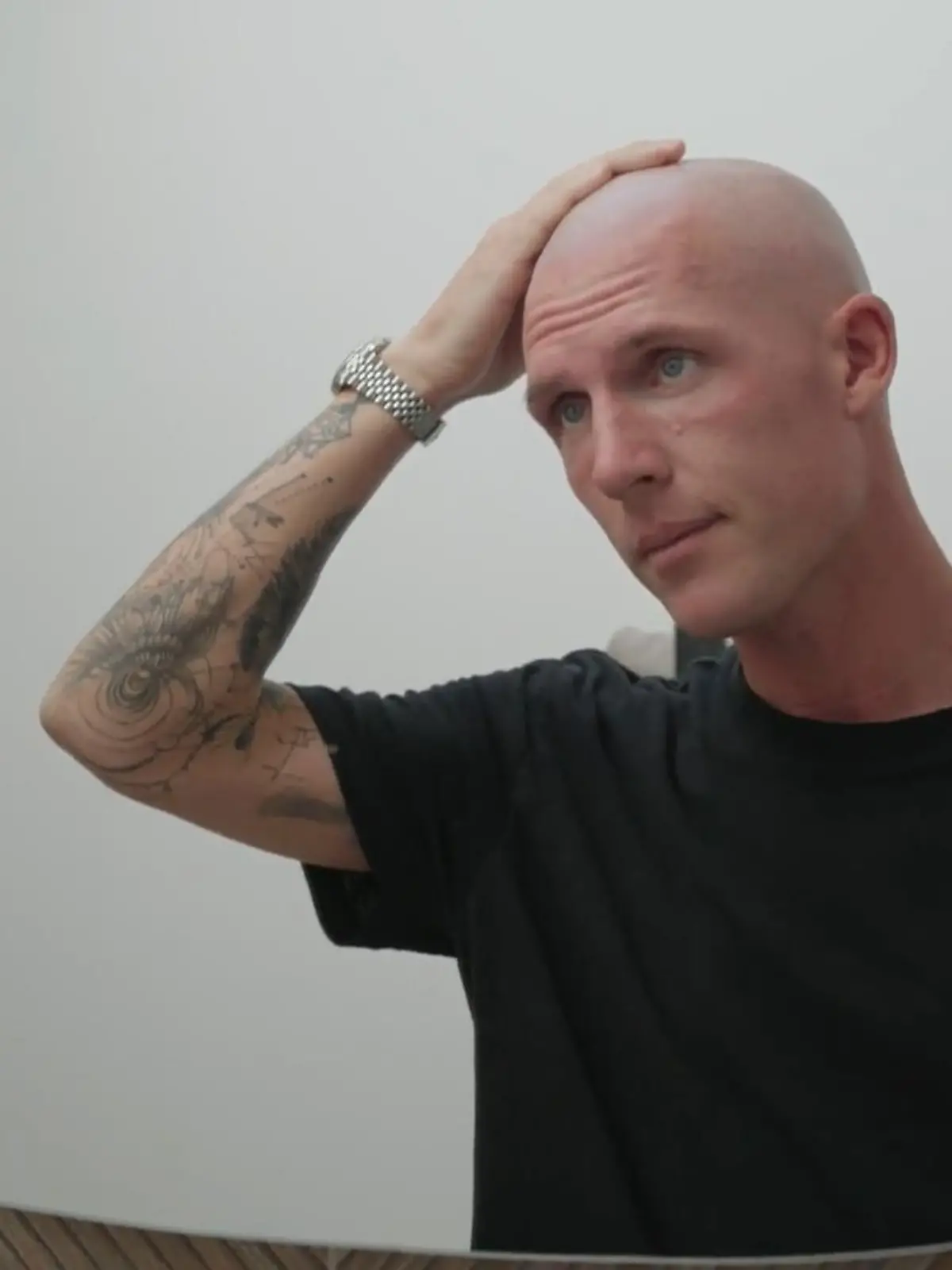 Bild zu: "Hoffnung dank diesem Medikament? So bekämpft Tobias Wolf seinen Haarausfall"