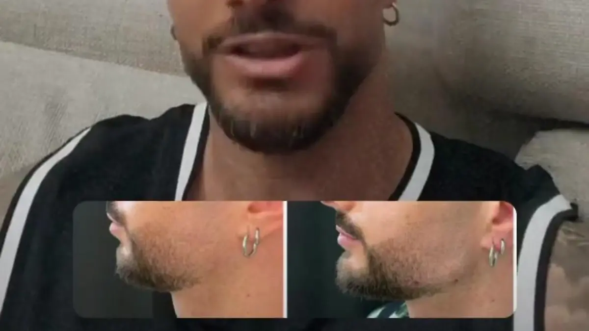 Julian Evangelos vor und nach seiner Jawline-Behandlung.