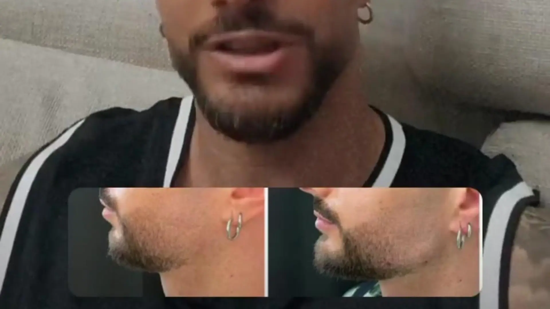 Julian Evangelos vor und nach seiner Jawline-Behandlung.