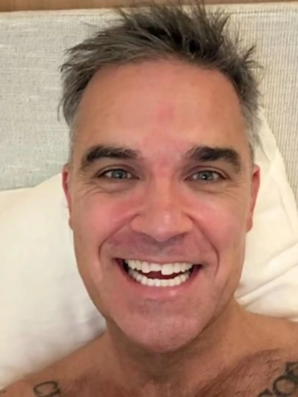Bild zu: "Robbie Williams überrascht mit neuem Look – „Reparatur oder Rebranding?”"