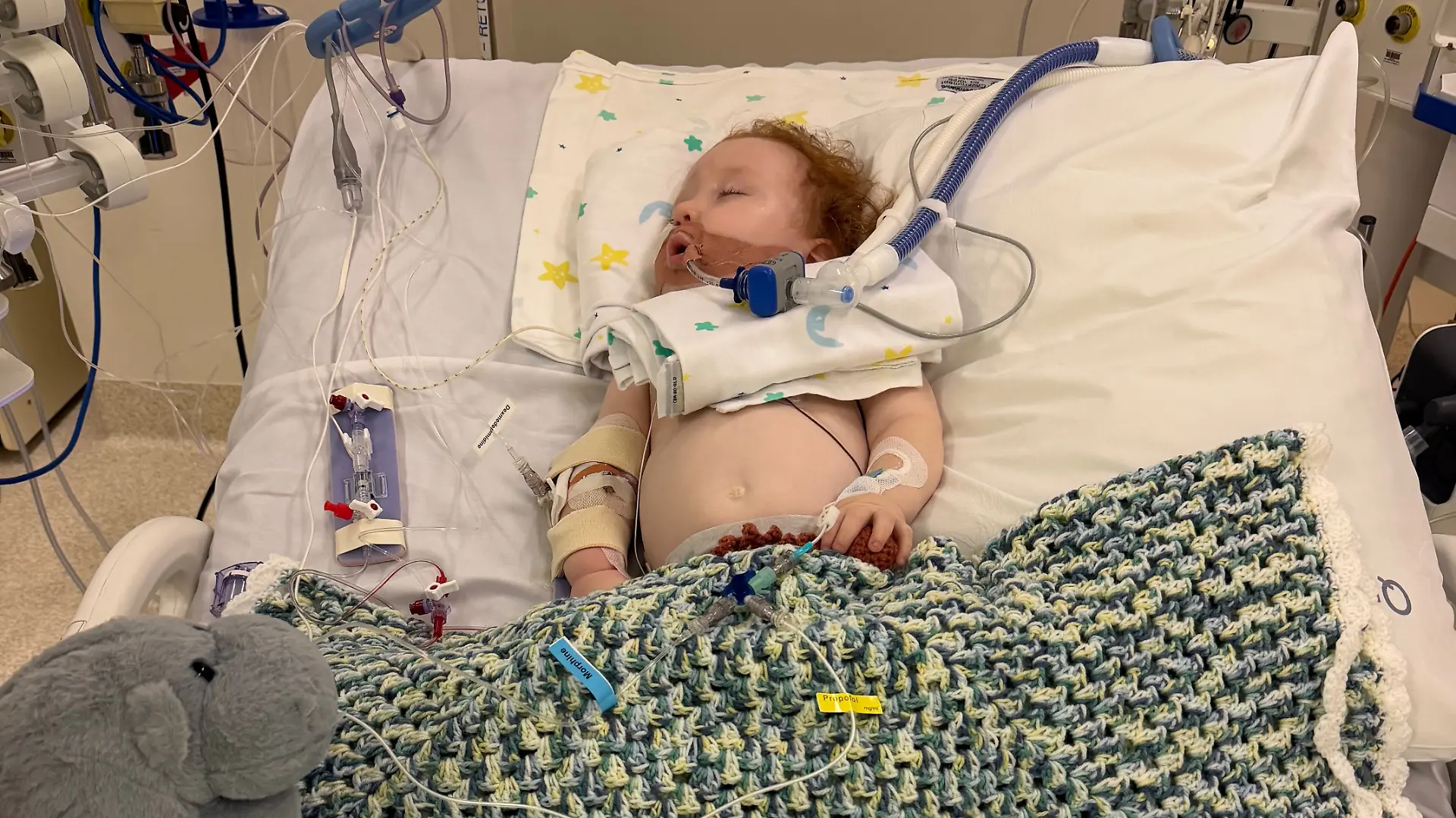 Tragischer Backunfall: Baby auf Intensivstation in Australien.