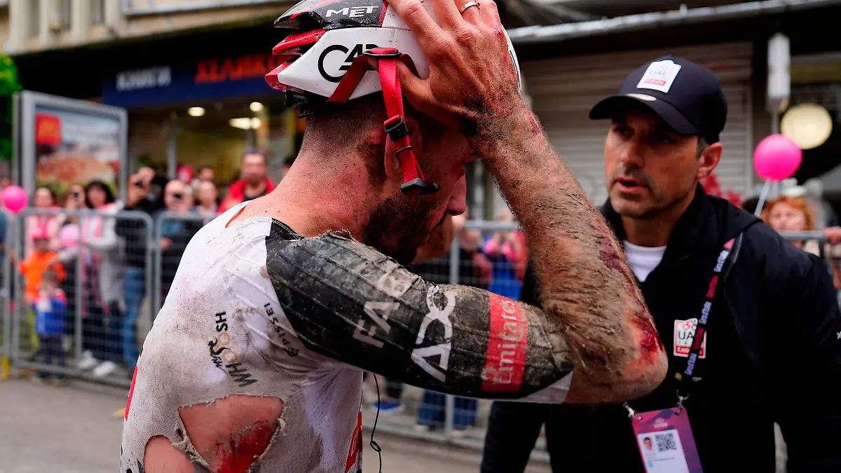 Mitfavorit Adam Yates stürzte beim Giro d'Italia schwer.