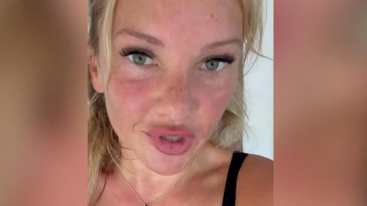 Evelyn Burdecki angefeindet – weil sie zu viel Zucker isst?! TV-Star hat eine Fettleber