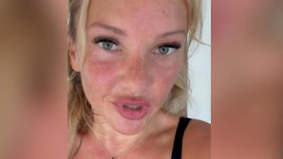 Bild von Evelyn Burdecki angefeindet – weil sie zu viel Zucker isst?!