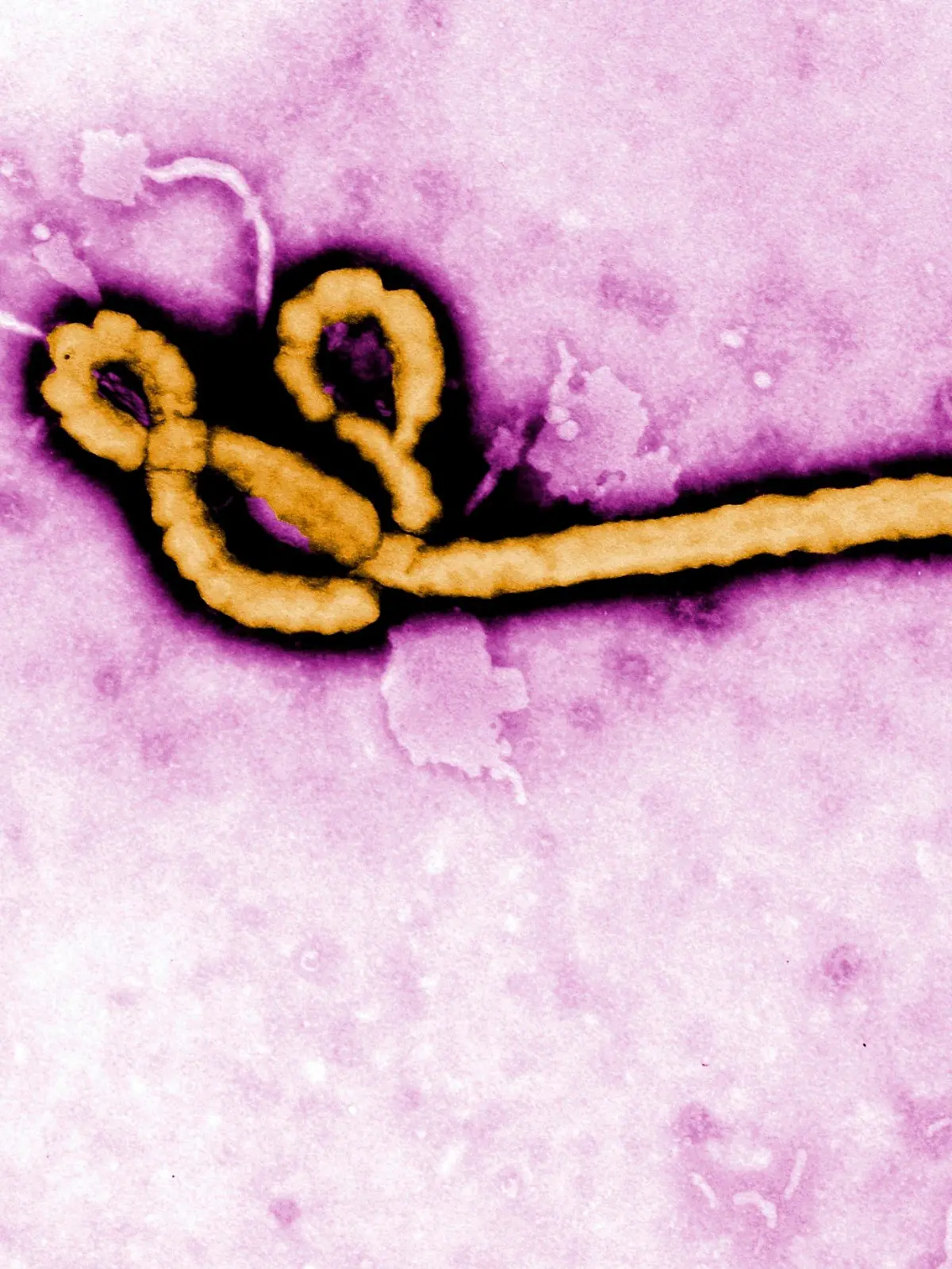 Congo Ebola