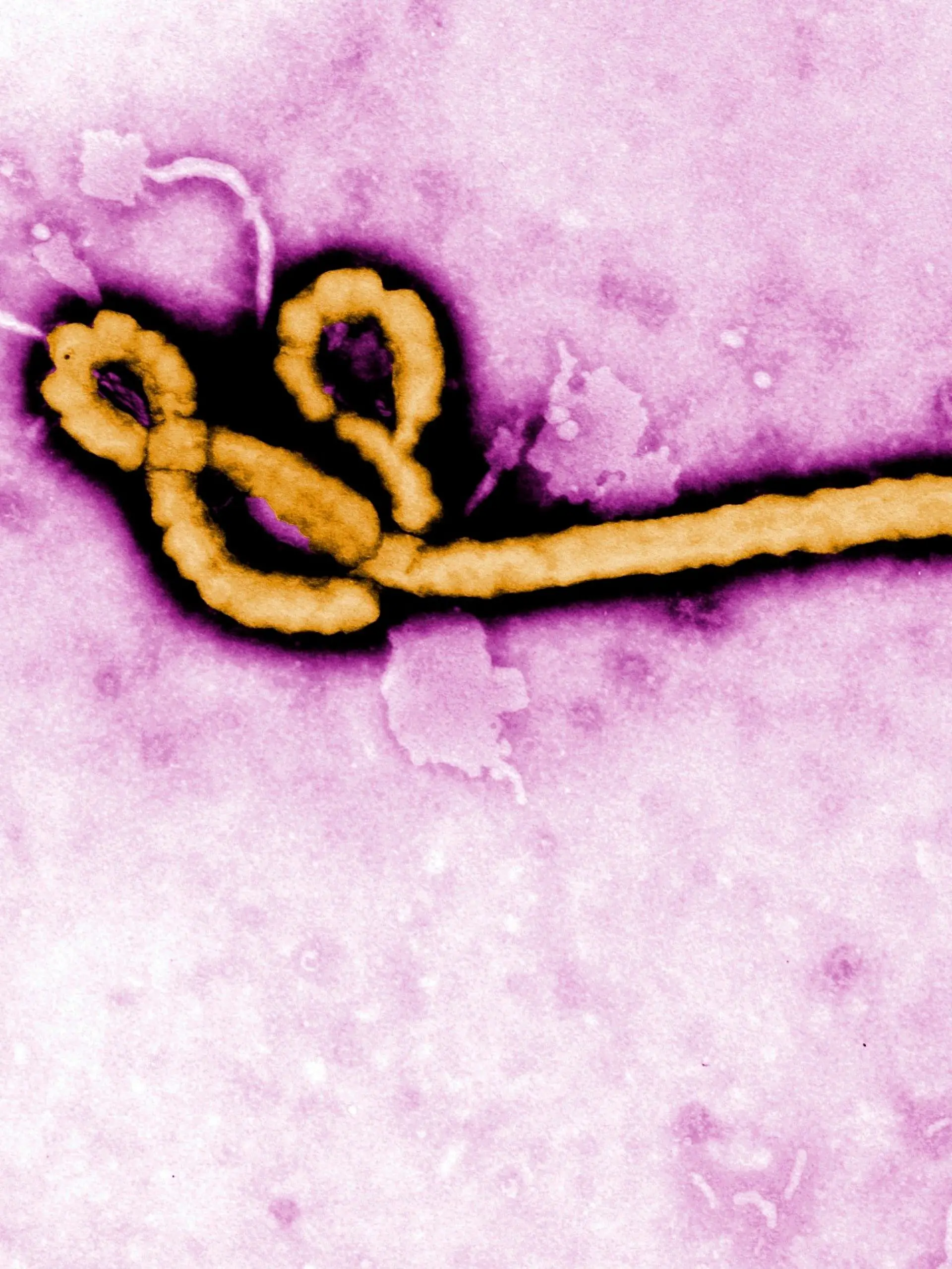 Congo Ebola