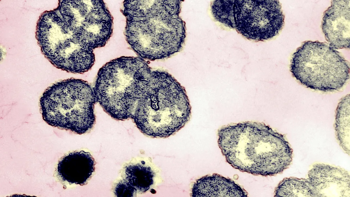 NEISSERIA GONORRHOEAE