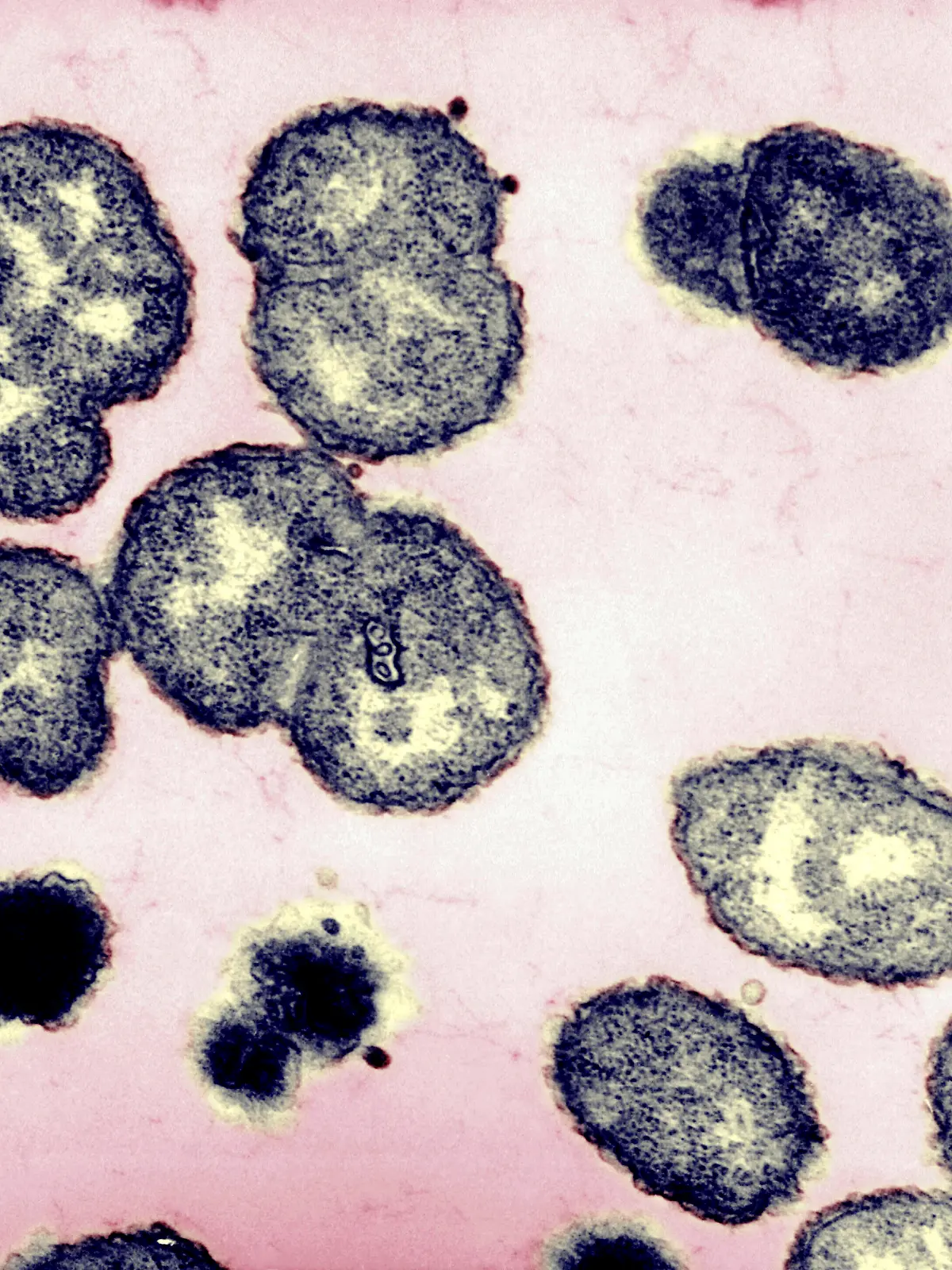 NEISSERIA GONORRHOEAE