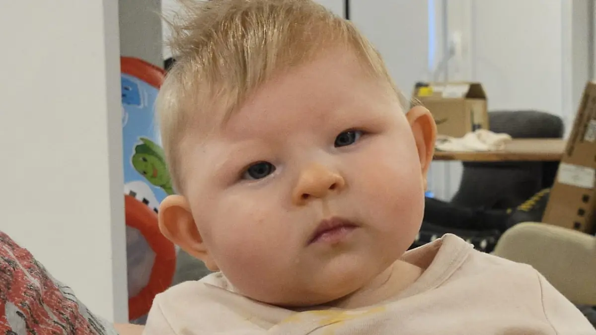 Lea ist noch kein Jahr alt und hat wegen ihres seltenen Gendefekts schon viel mitgemacht.