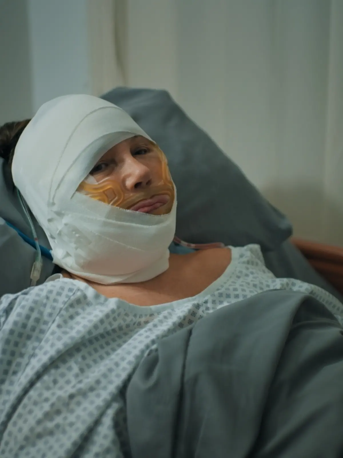 Natascha Ochsenknecht liegt mit einem Kopfverband nach ihrer Halsstraffung im Krankenbett