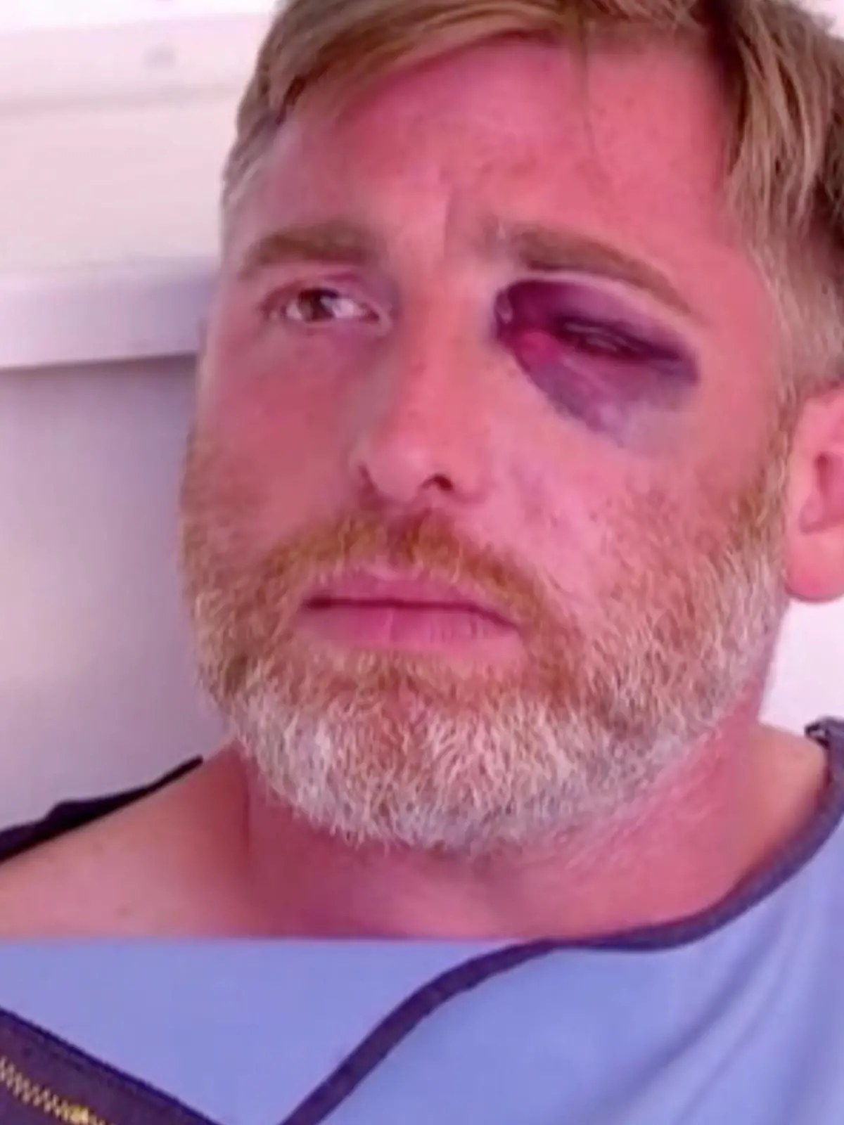 Georgien: Kameramann Alexander Lashkarava schwer verletzt nach Angriff bei CSD Parade