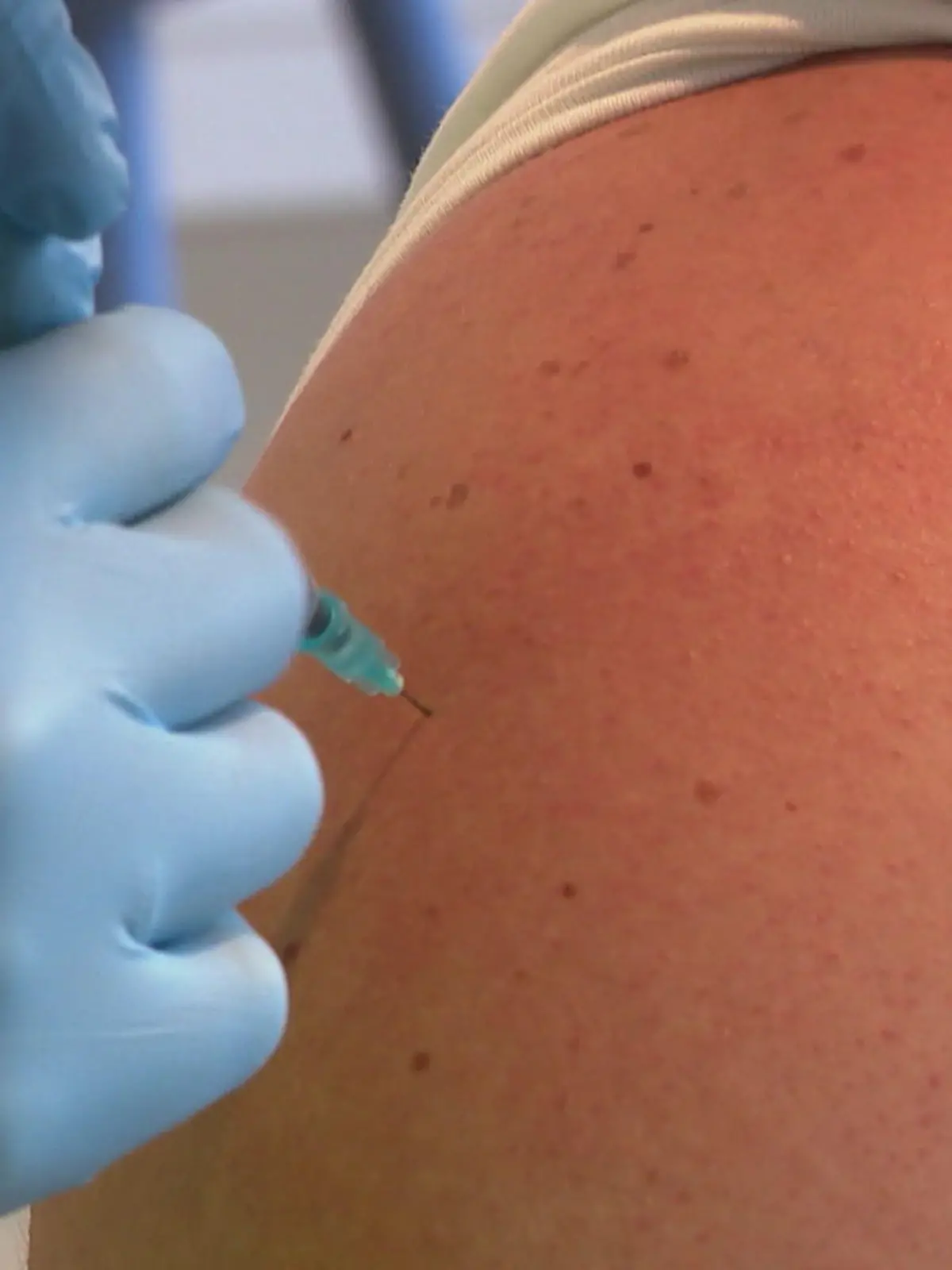 Bild zu: "75 Prozent weniger Borreliose-Fälle? Neue Impfung macht Hoffnung"