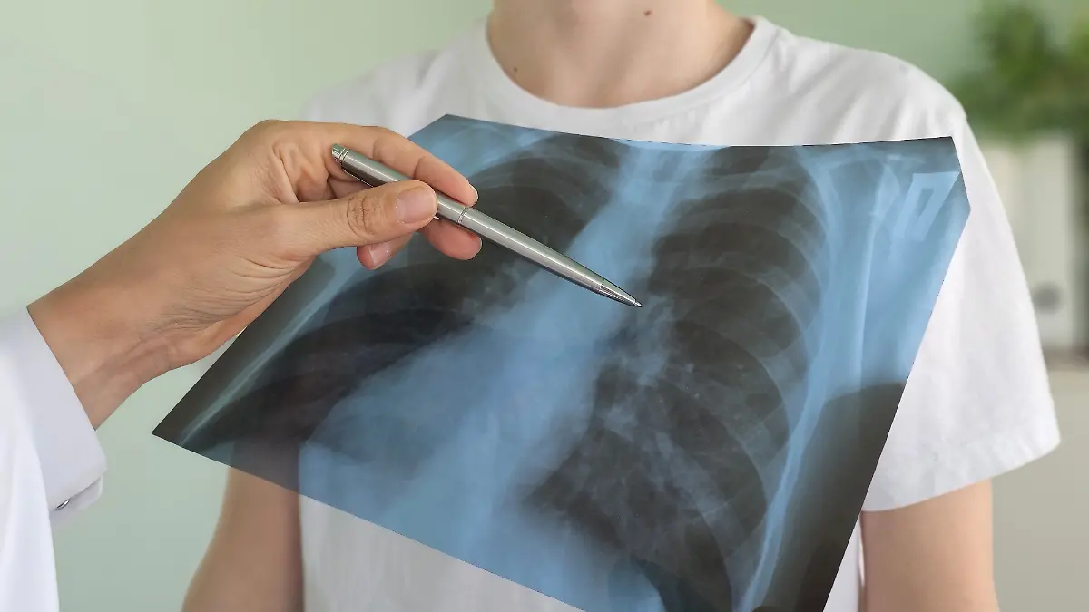 Wie funktioniert eine Lungentransplantation?