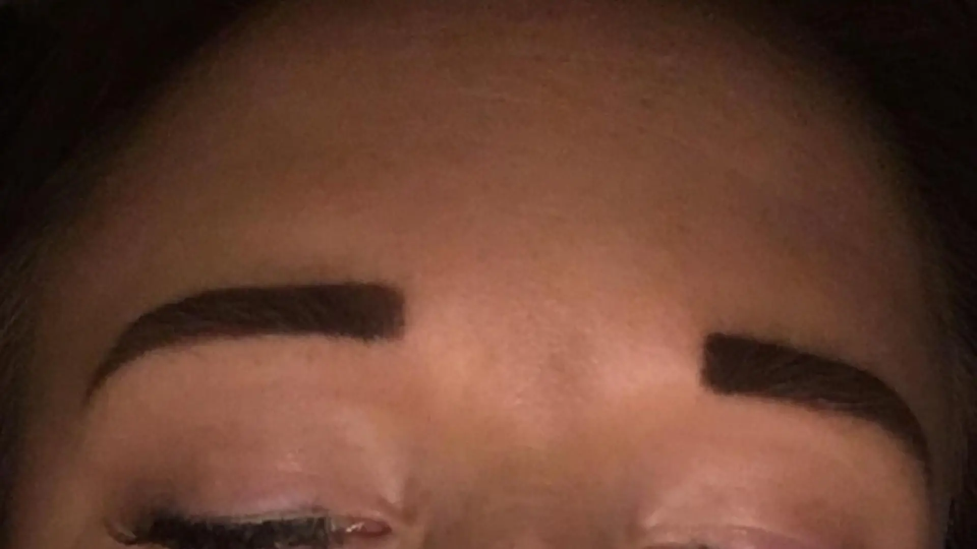 PIC FROM Kennedy News and Media (PICTURED: BILLIE ROOCROFT'S LIPS SWELLING UP ON THE DAY SHE HAD LIP FILLERS DONE BY BELISSIMO RIVINGTON AESTHETICS AT HER HOME) A nurse claims a lip filler treatment left her lips so swollen she looked like ‘The Elephant Man’ – leaving her toddler terrified of her. Billie Roocroft, 23, had never been happy with her ‘thin’ lips and, inspired by celebs flaunting fuller pouts, decided to take the plunge and get fillers. The mum-of-one claims the £120 offer for 1ml of filler administered in her living room by a mum and daughter from Belissimo Rivington Aesthetics resulted in an A&E visit after her lips doubled in size. SEE KENNEDY NEWS COPY - 0161 697 4266