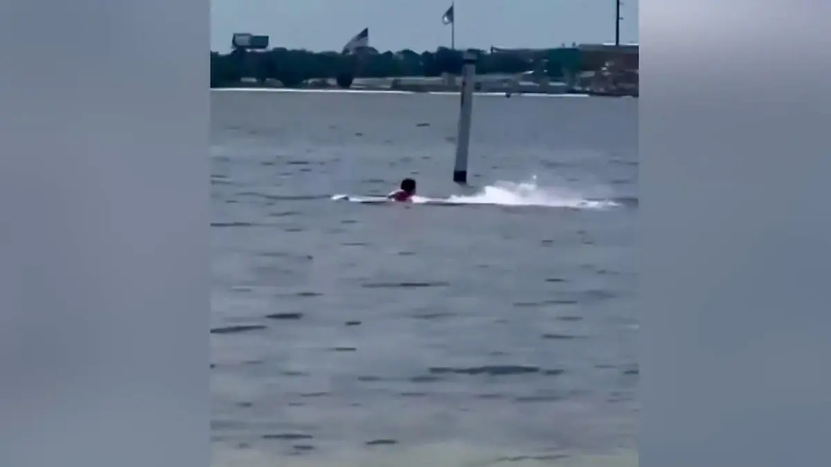Schockierende Aufnahmen! Hai beißt Mann mehrfach in beide Arme – Not-OP Brutaler Angriff vor Marinebasis