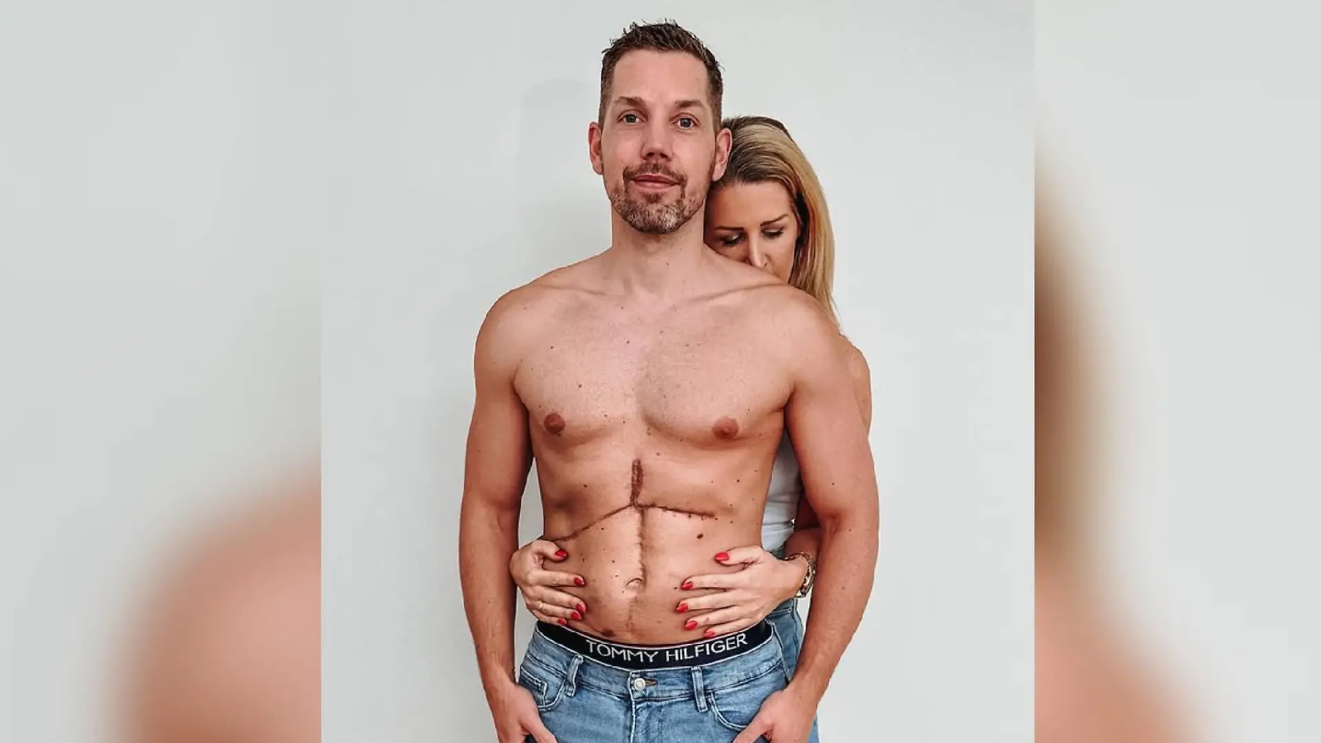 Eine Lebertransplantation rettete Hendrik Versts Leben. 
