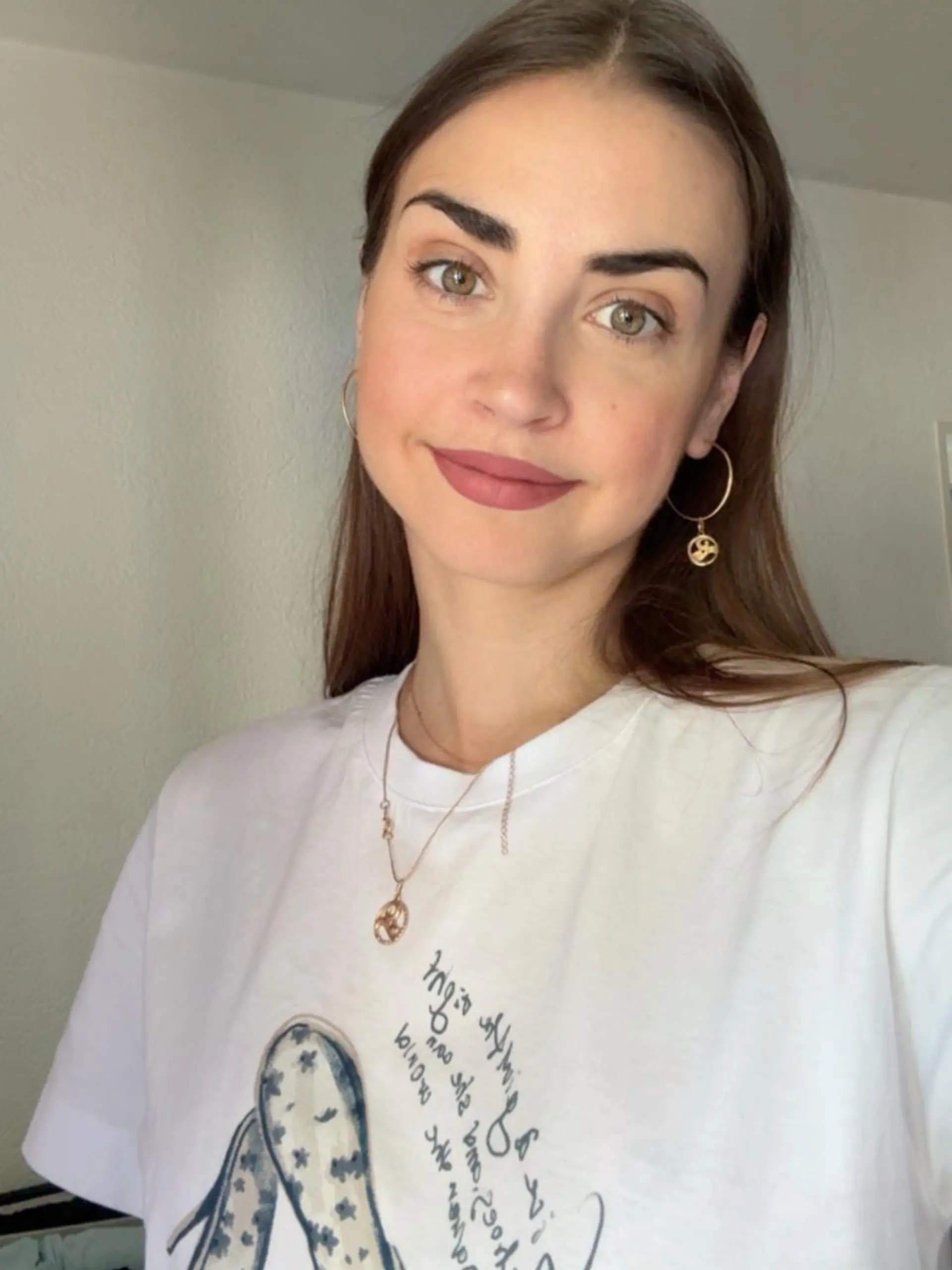„Let’s Dance”-Star Ekaterina Leonova meldet sich nach ihrer fünfstündigen Zahn-OP zu Wort.
