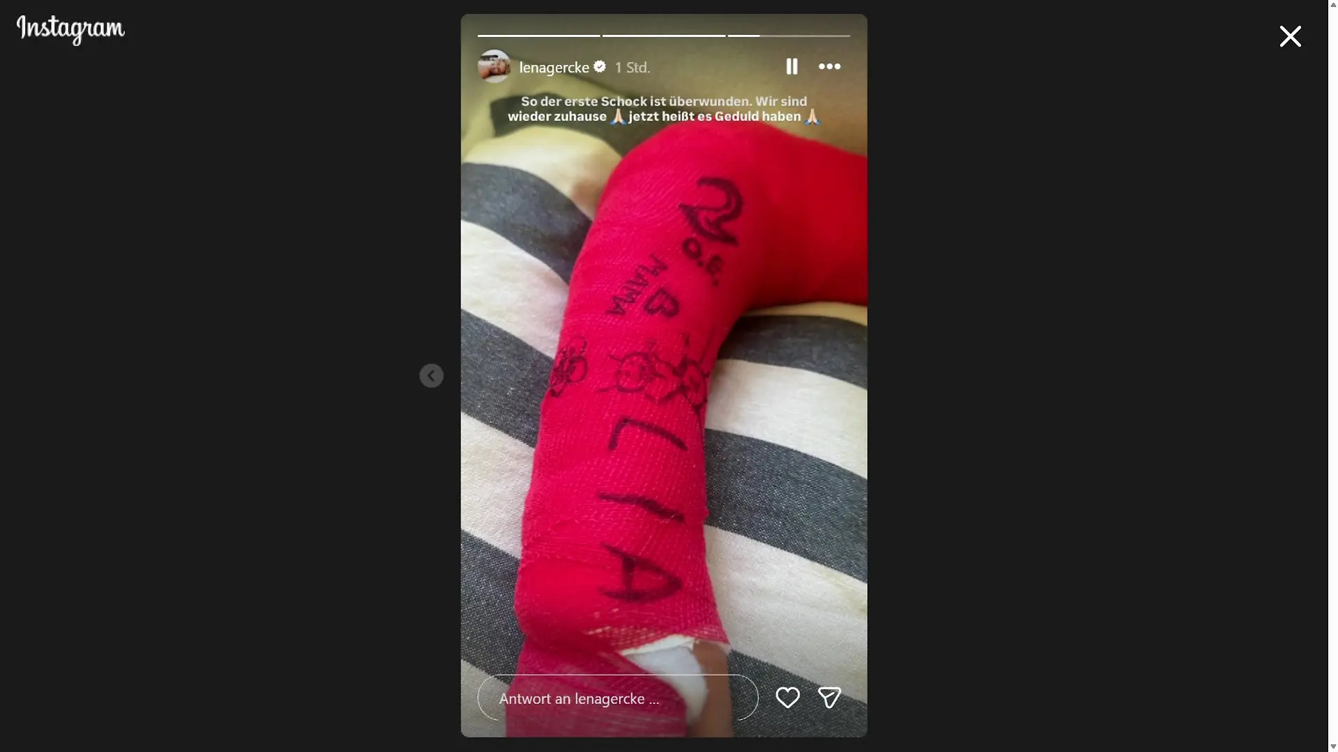 Der Gips mit den Unterschriften von Lena Gerckes Töchtern Zoe und Lia