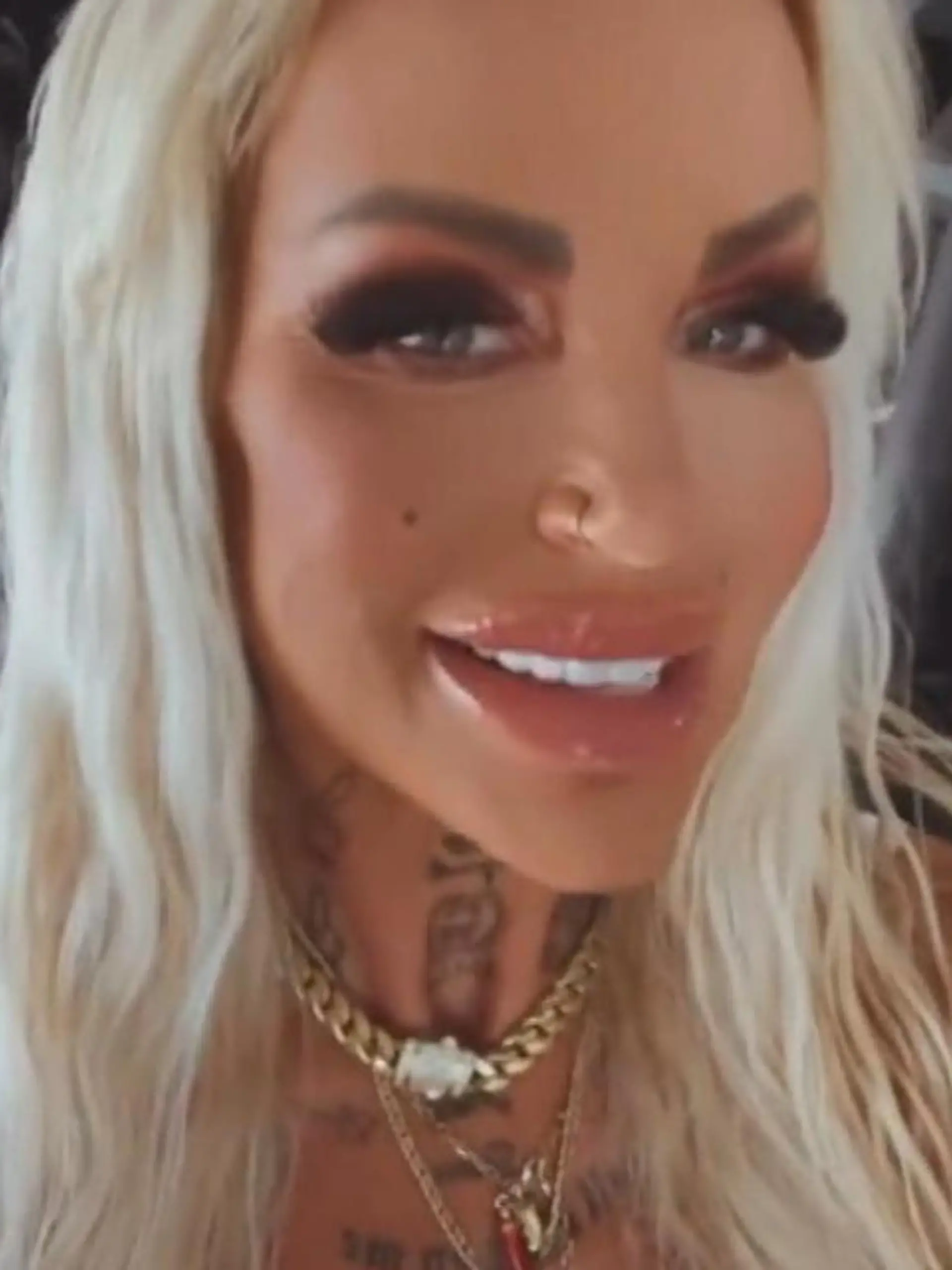Bild zu: "Nach Po-Pfusch-OP! Gina-Lisa Lohfink setzt jetzt auf DIESE Methode"