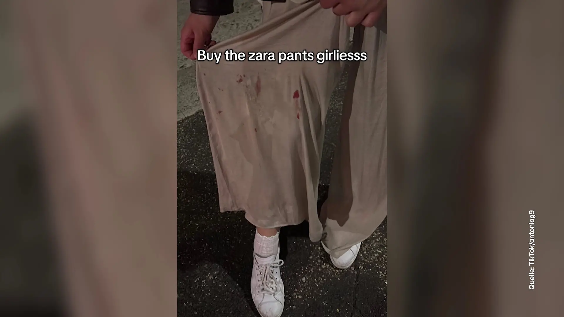 Unfall-Hose von Zara hat eigenen Hashtag.