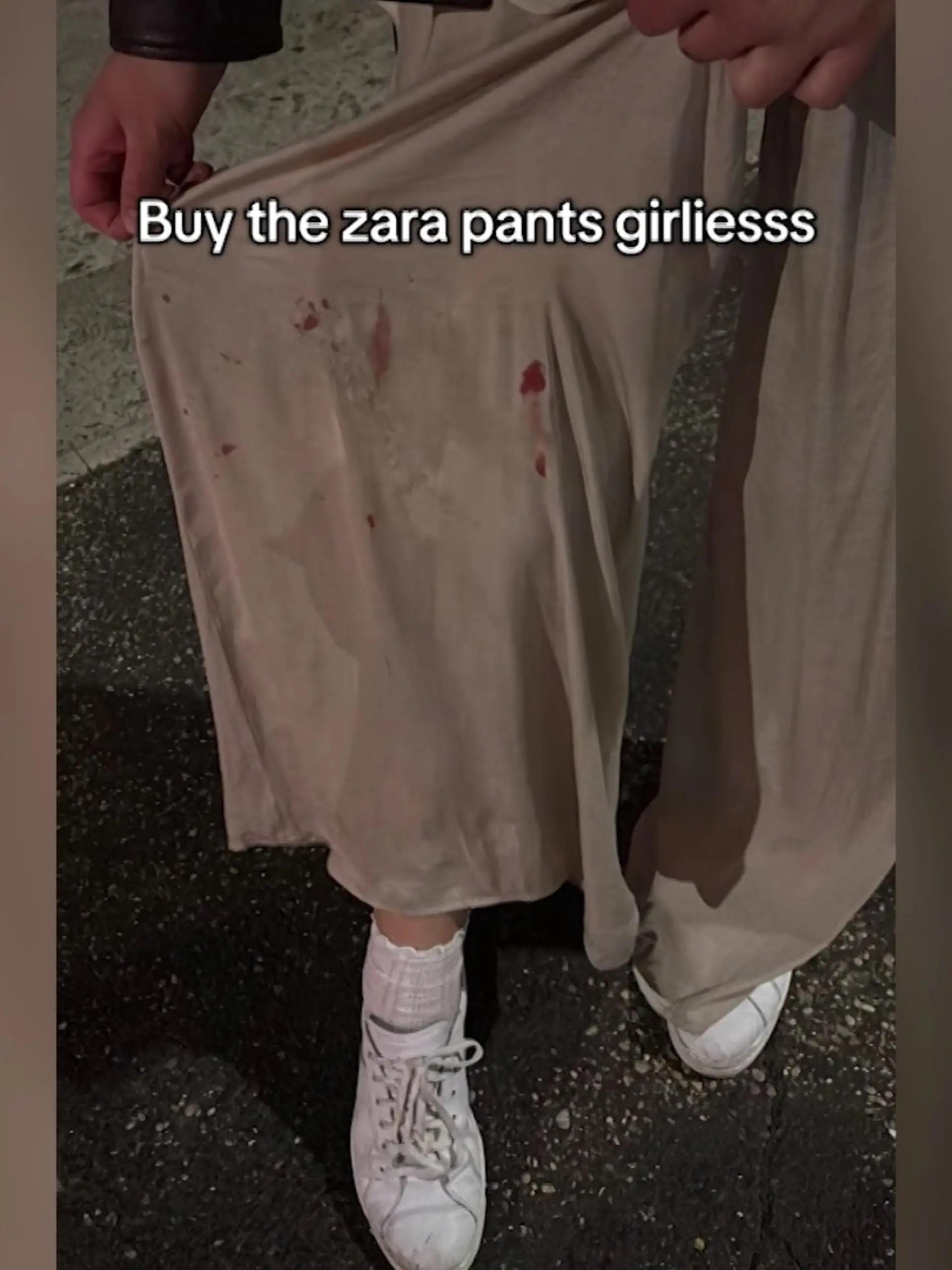 Unfall-Hose von Zara hat eigenen Hashtag.
