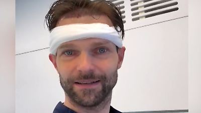 Bild von Beauty-Eingriff bei „Let's Dance"-Profitänzer! Vadim Garbuzov legt sich unters Messer