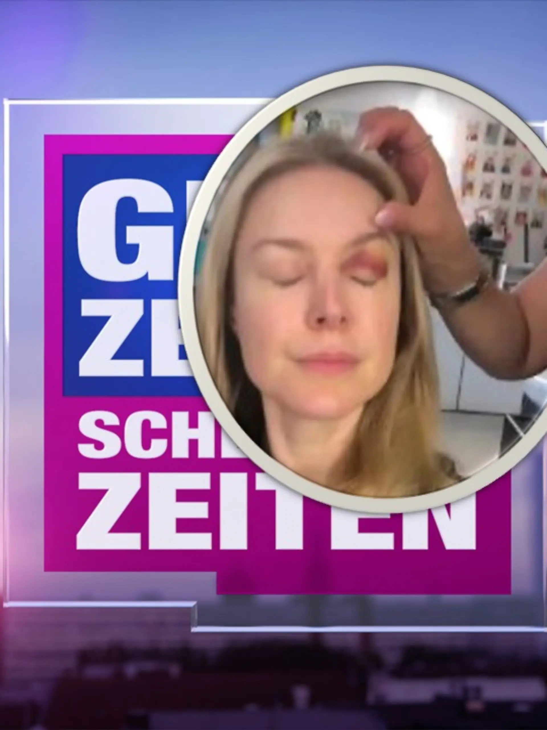Bild zu: "Das tut weh! Schauspielerin Nina Ensmann zeigt blaues Auge"