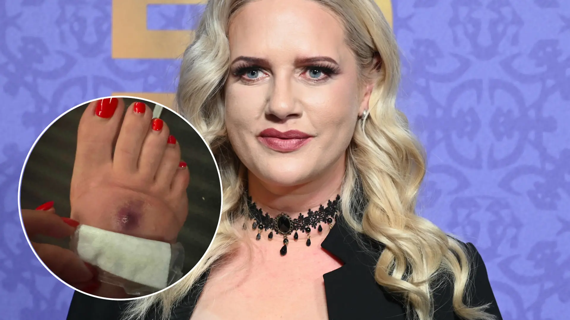 Bild zu: "Kriebelmücken-Drama! Sarah Knappik lahm gelegt"
