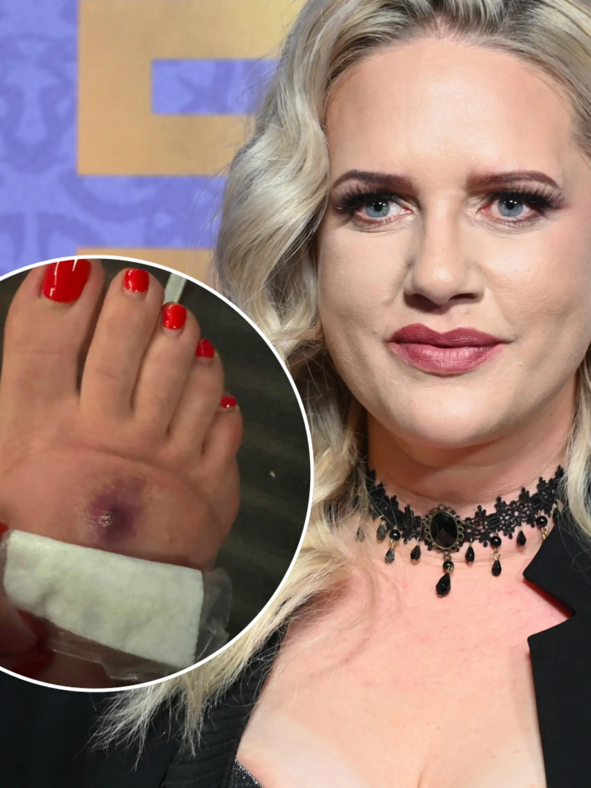 Bild zu: "Kriebelmücken-Drama! Sarah Knappik lahm gelegt"