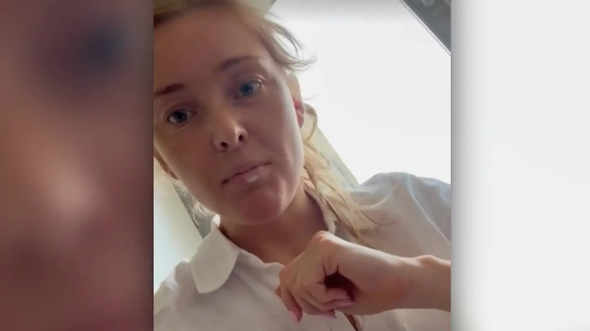 Bild zu: "Therapie unmöglich! Rückschlag für Patrice Aminati im Krebs-Kampf"