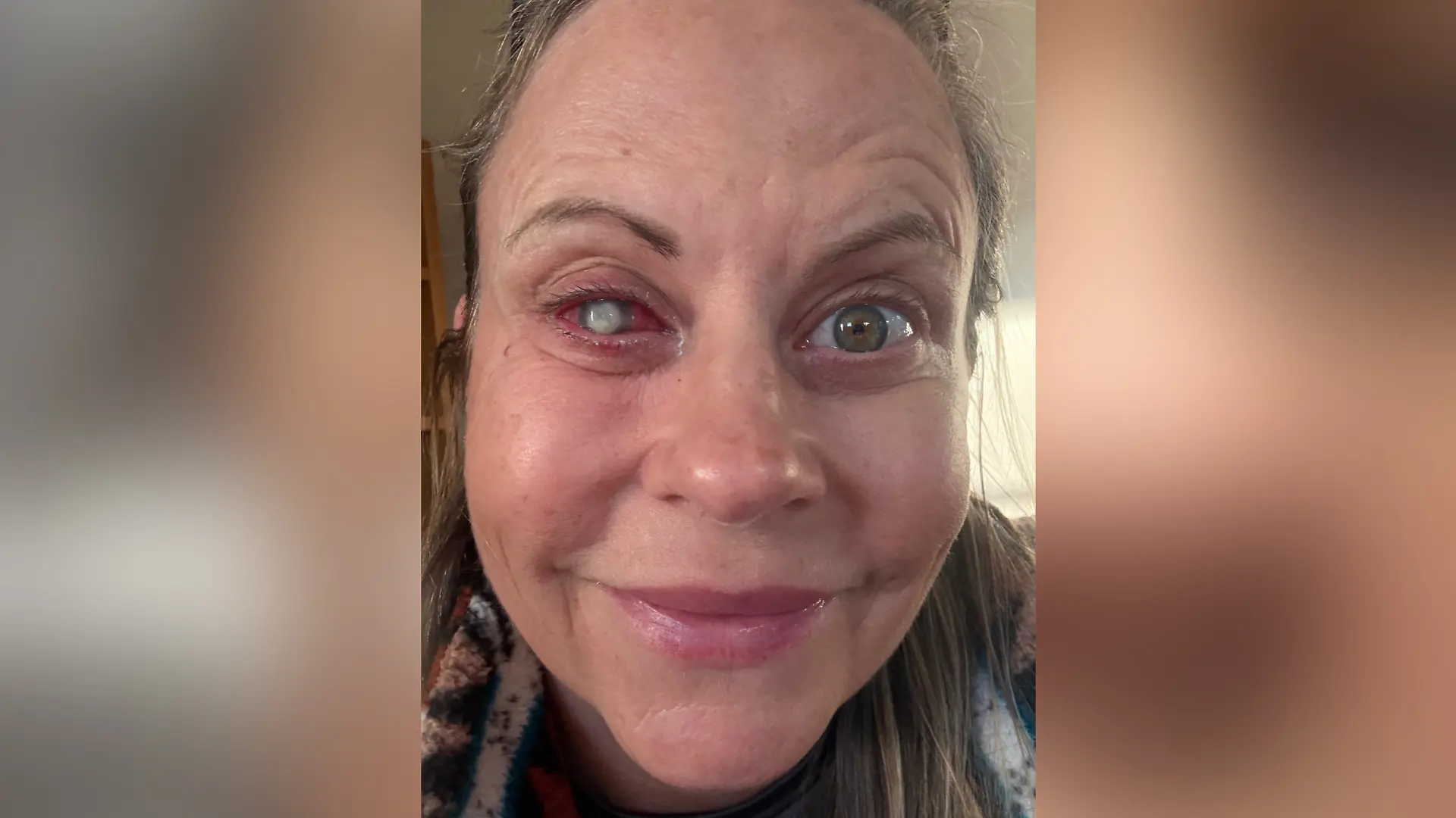 Innerhalb weniger Tage kann Emma auf ihrem Auge nichts mehr sehen. Doch erste Untersuchungen beim Arzt führen zu keinem Befund.