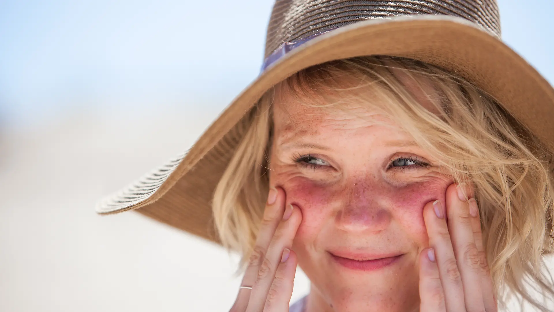 Auf TikTok verbreitet sich der Trend „Cute Sunburn”.